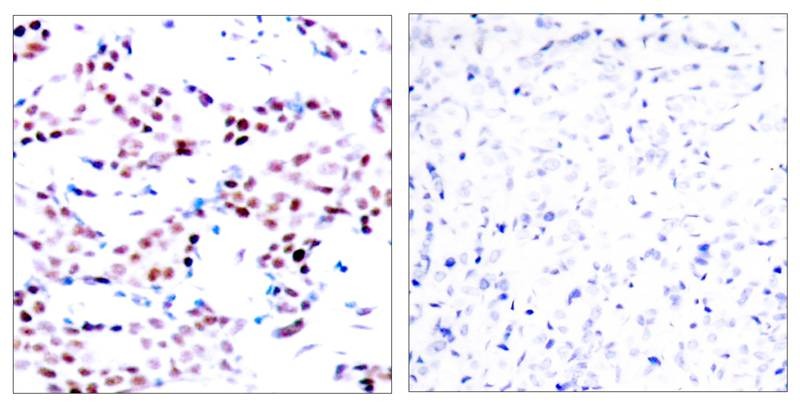 Anti-Phospho-JUN (Thr91) Polyclonal Antibody