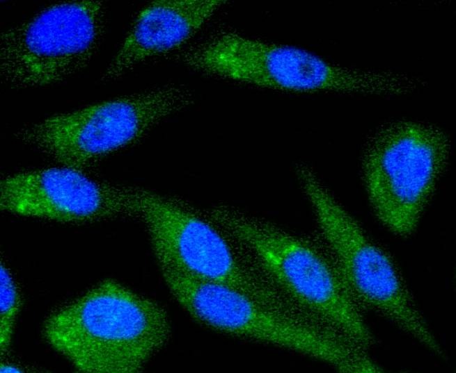 Anti-CHEK1 Antibody (6N369)
