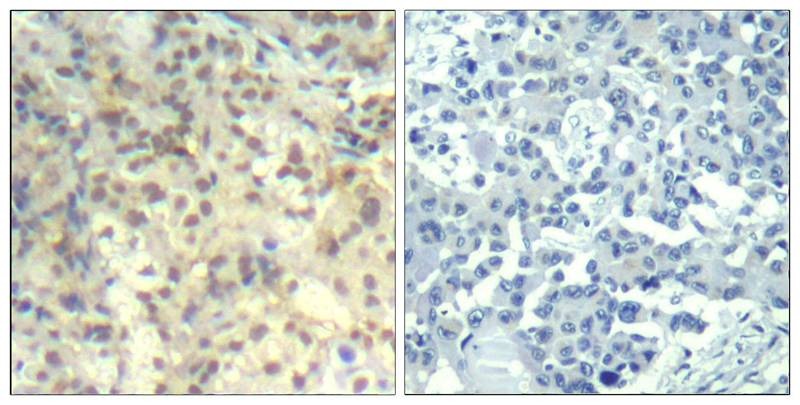 Anti-Phospho-Cofilin (Tyr139) Polyclonal Antibody