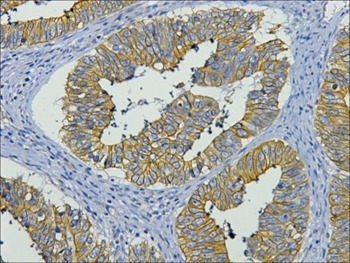 Anti-KRT19 Antibody (2S884)
