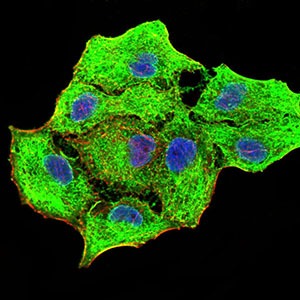 Anti-KRT5 Antibody (8E980)
