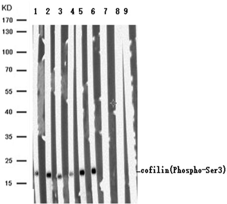 Anti-Phospho-Cofilin (Ser3) Polyclonal Antibody 2