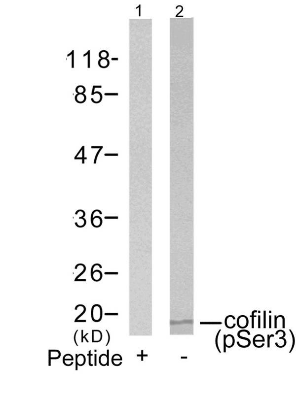 Anti-Phospho-Cofilin (Ser3) Polyclonal Antibody 2