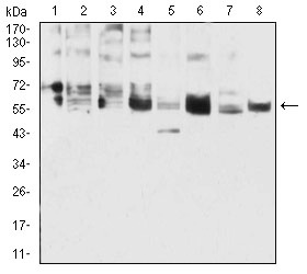 Anti-KRT5 Antibody (8E980)