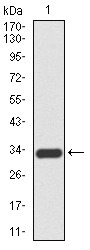 Anti-KRT5 Antibody (8E980)