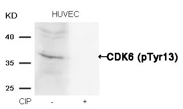 Anti-Phospho-CDK6 (Tyr13) Polyclonal Antibody