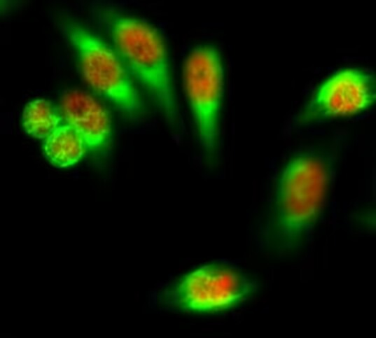 Anti-KRT7 Antibody (6S321)