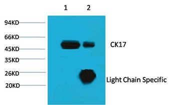 Anti-CK17 Antibody (5Z868)
