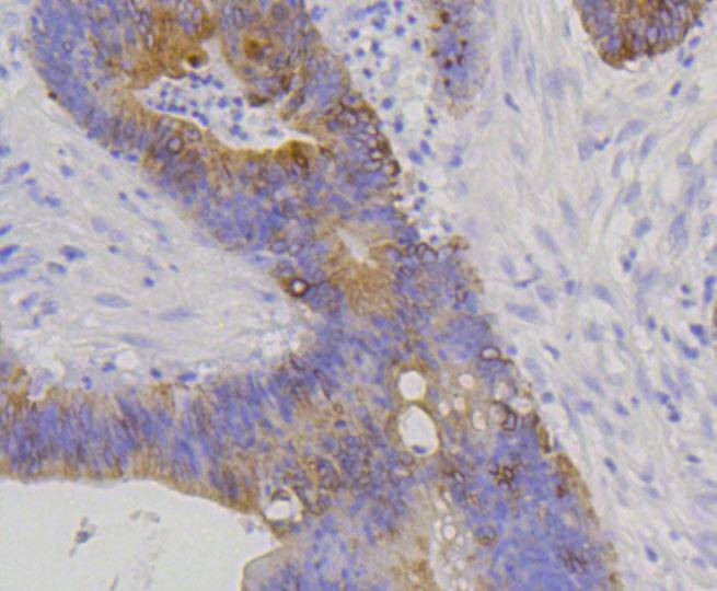 Anti-KRT20 Antibody (7P648)