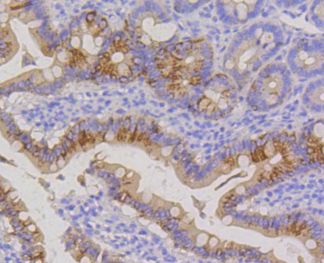 Anti-KRT20 Antibody (7P648)