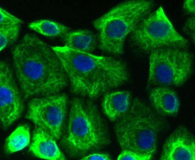 Anti-KRT19 Antibody (4B372)