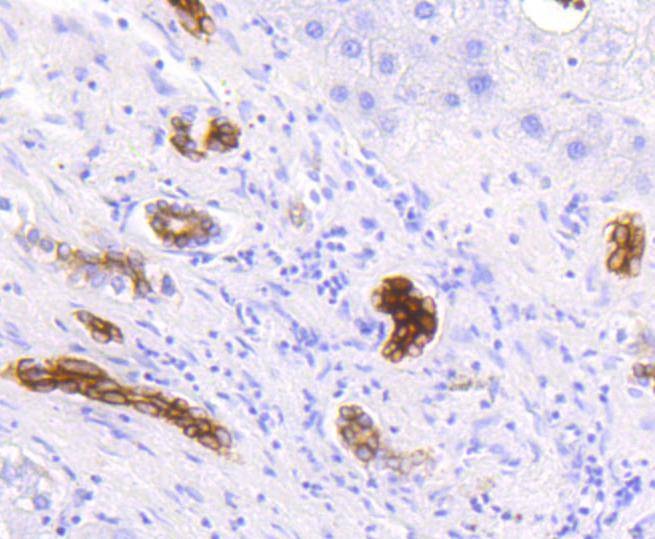 Anti-KRT19 Antibody (4B372)