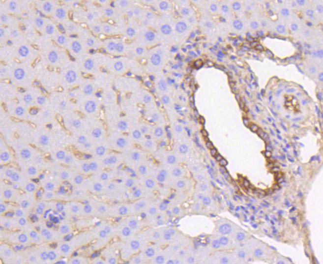 Anti-KRT19 Antibody (4B372)