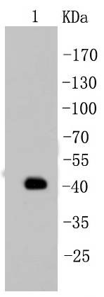 Anti-KRT19 Antibody (4B372)