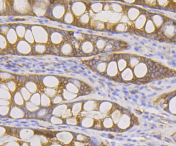 Anti-DIAPH1 Antibody (6T639)