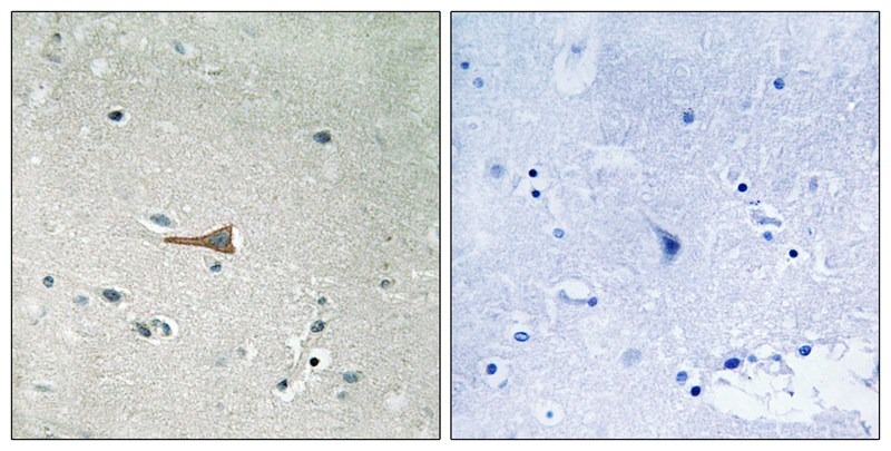 Anti-Phospho-DDR1 (Tyr513) Polyclonal Antibody