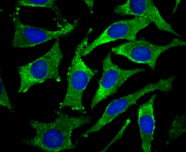 Anti-DCPLA Antibody (2R679)