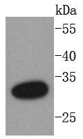 Anti-DARPP-32 Antibody (1B13)