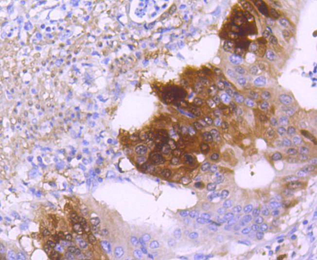 Anti-DARPP-32 Antibody (1B13)