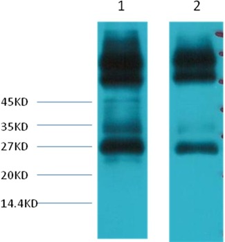 Anti-EFHD1 Antibody (5L981)
