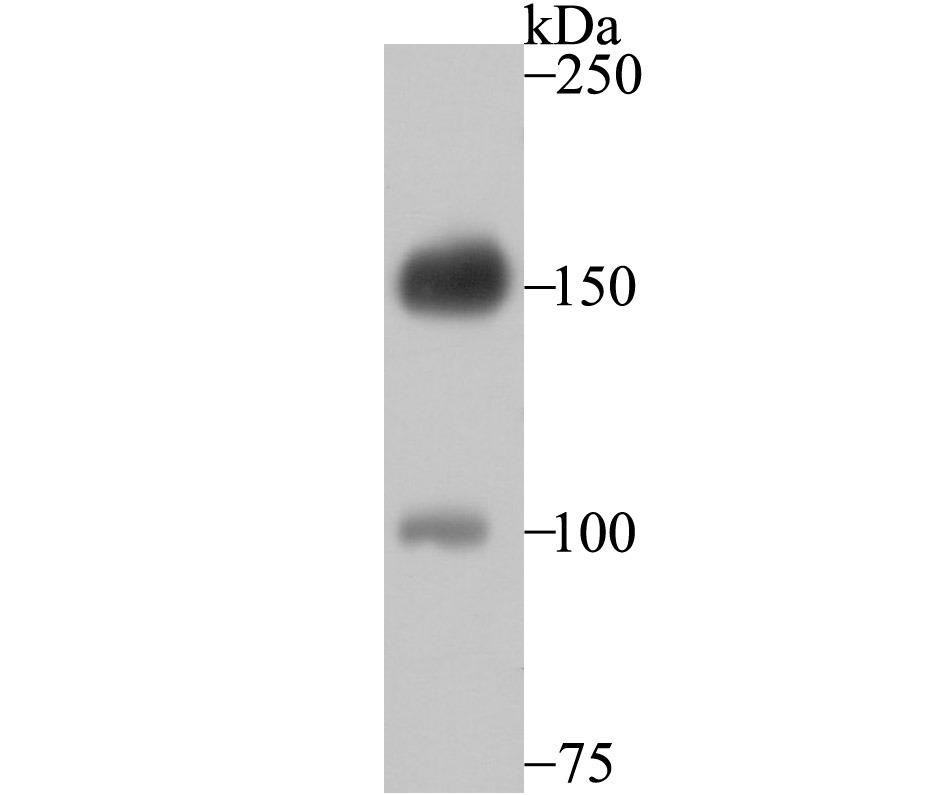 Anti-DSG-2/Desmoglein-2 Antibody (5U33)