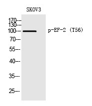 Anti-Phospho-EEF2 (Thr56) Polyclonal Antibody