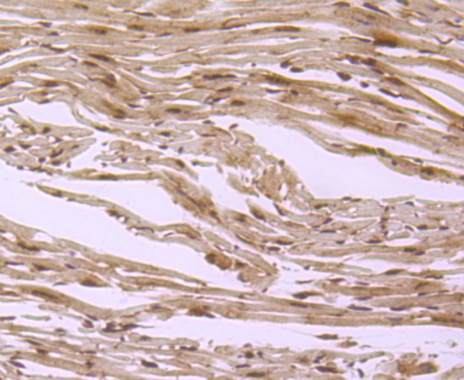 Anti-S1PR1 Antibody (9T480)