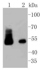 Anti-Desmin Antibody (2D838)