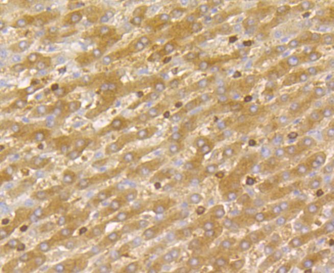 Anti-DIAPH1 Antibody (6T639)
