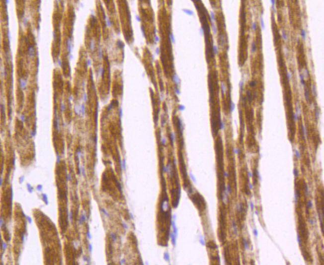 Anti-Desmin Antibody (2D838)