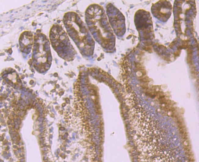 Anti-DSG-2/Desmoglein-2 Antibody (5U33)