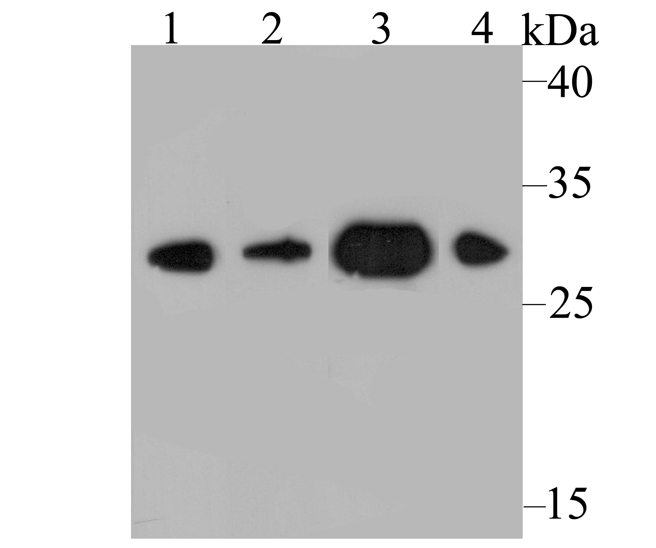 Anti-DDAH2 Antibody (4B33)