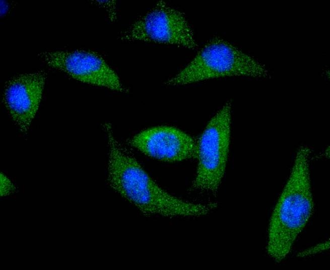 Anti-DARPP-32 Antibody (1B13)