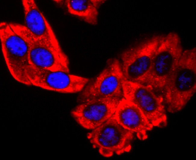 Anti-S1PR1 Antibody (9T480)