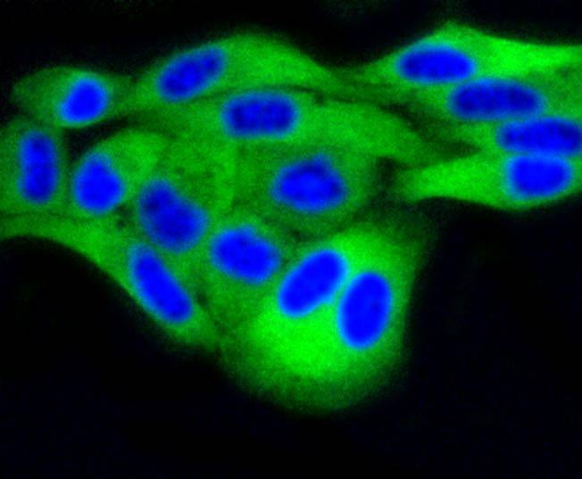 Anti-DUSP6 Antibody (2Q808)