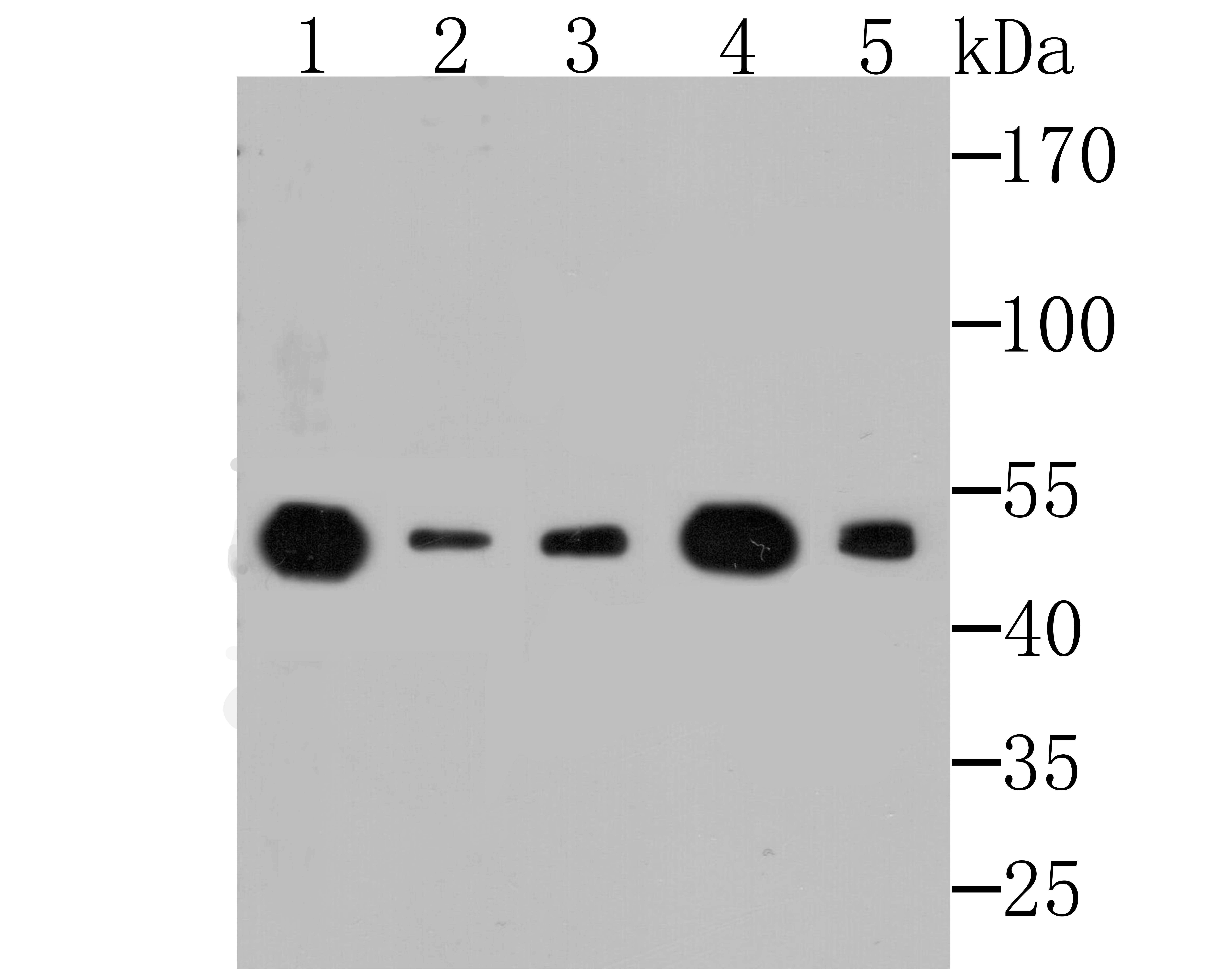 Anti-EEF1A1 Antibody (9F149)