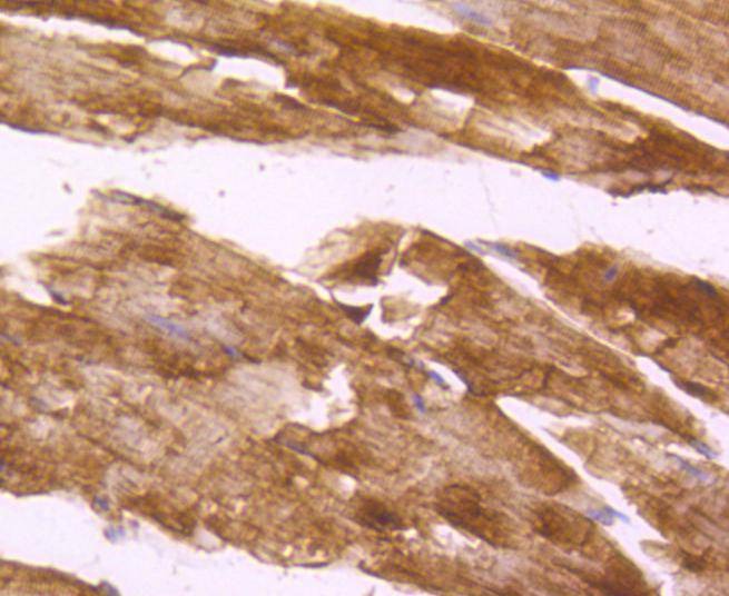 Anti-Desmin Antibody (2D838)