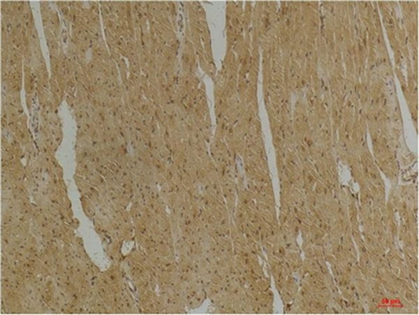 Anti-Desmin Antibody (2U295)