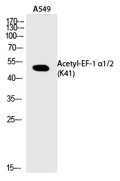 Anti-Acetyl-EF-1 α1/2 (Lys41) Polyclonal Antibody