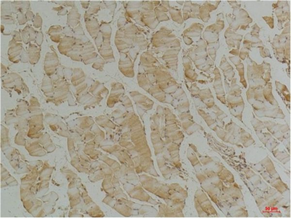 Anti-Desmin Antibody (2U295)