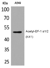Anti-Acetyl-EF-1 α1/2 (Lys41) Polyclonal Antibody