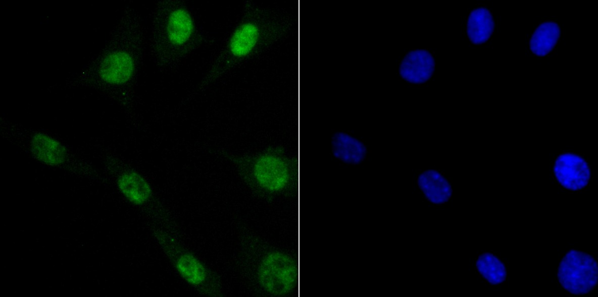 Anti-DDB1 Antibody (1Y859)