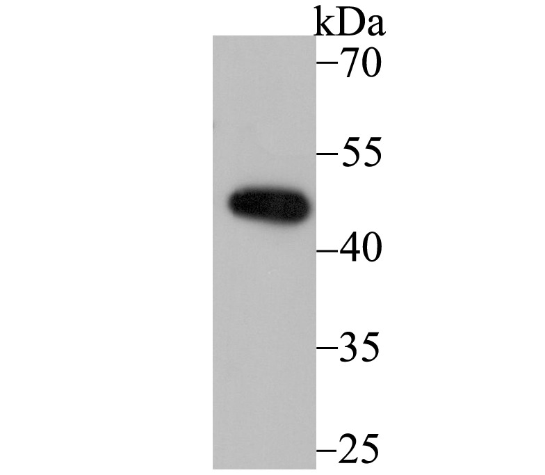 Anti-DDB2 Antibody (1O273)