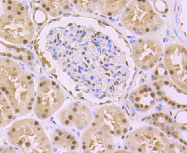 Anti-DDB1 Antibody (1Y859)