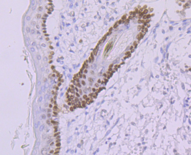 Anti-DDB2 Antibody (1O273)