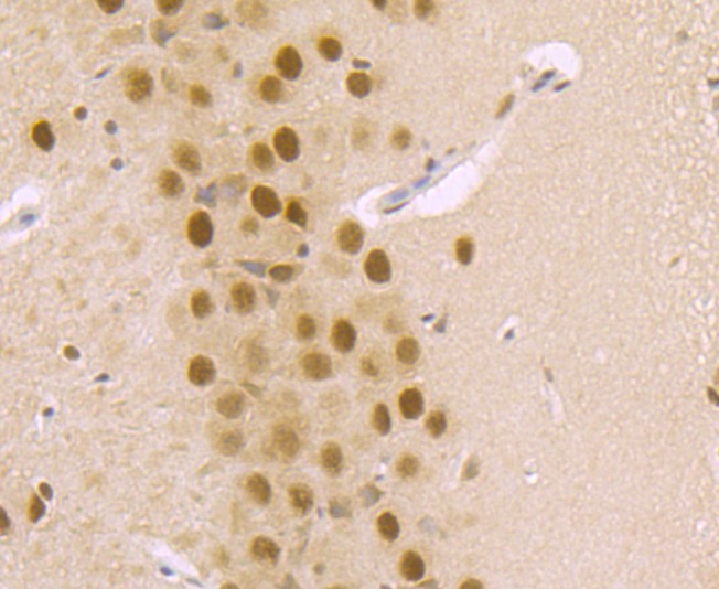 Anti-DDB1 Antibody (1Y859)