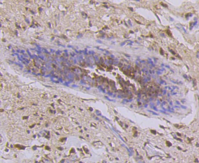 Anti-KRT7 Antibody (4X26)