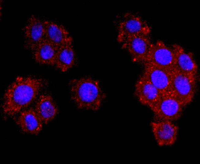 Anti-Dysferlin Antibody (4C391)