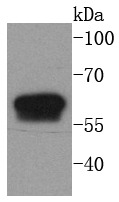 Anti-KRT6A Antibody (4G523)