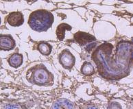 Anti-KRT9 Antibody (1T211)